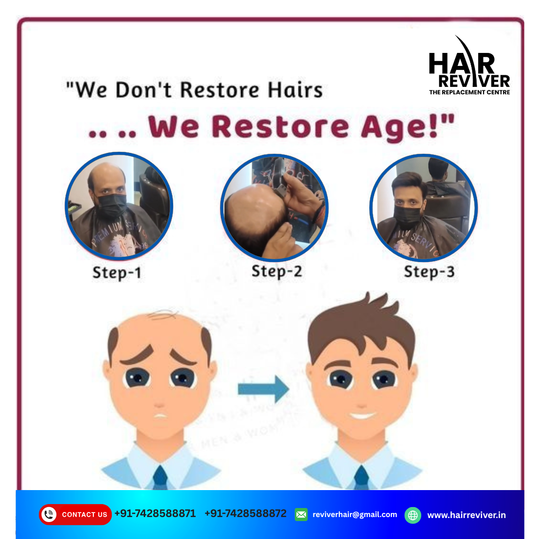 Hair Patch Before After